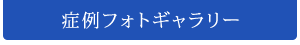 症例フォトギャラリー
